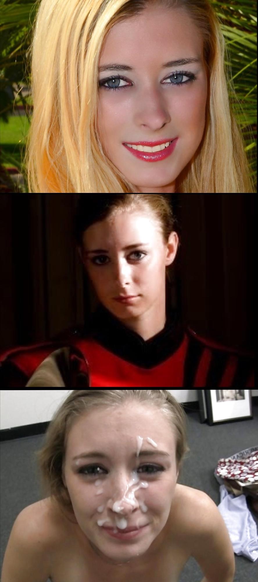 25P Before and After Facials 4