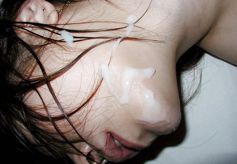 20P Cum 10