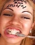 12P Braces and cum