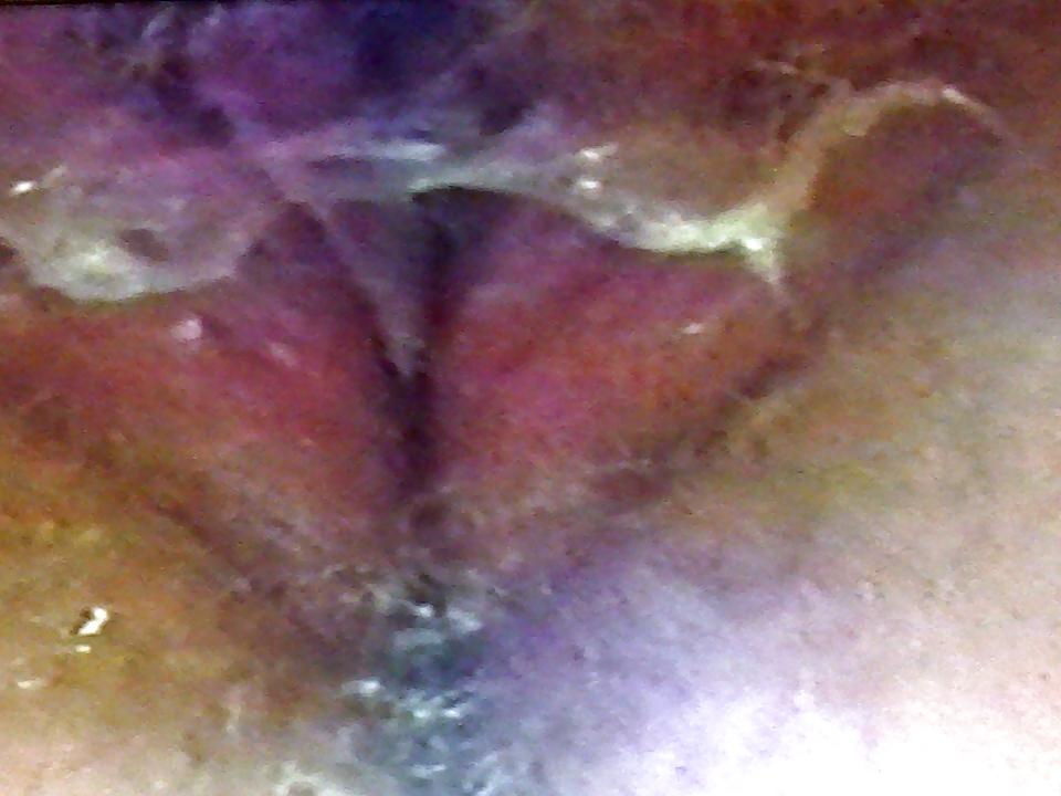 10P Carole's hairy cunt fucked by man in the park