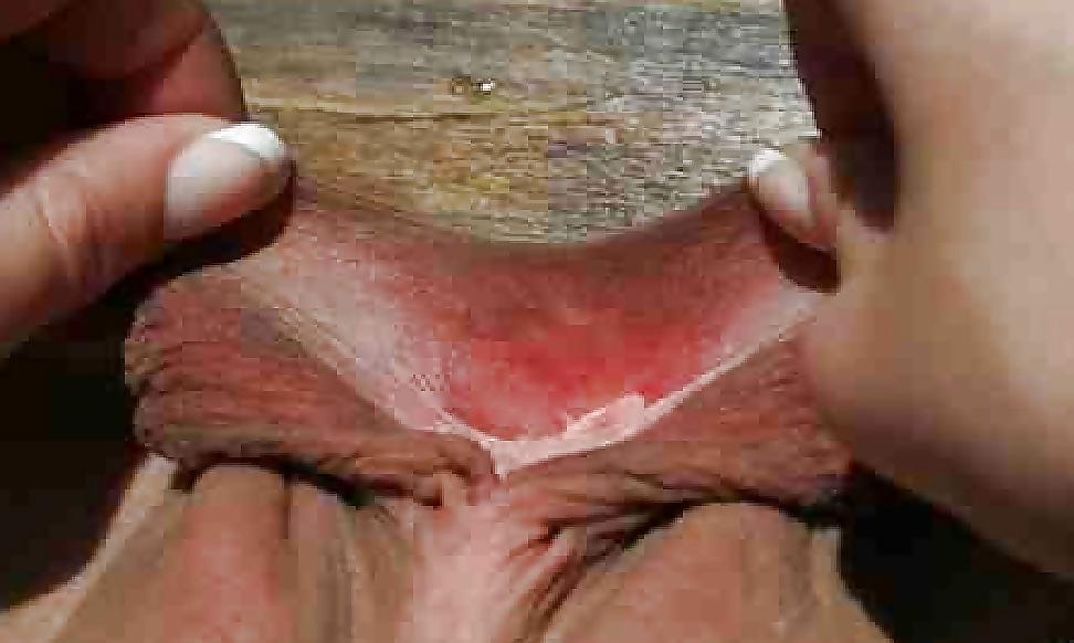 25P Big Pussy Lips (20)