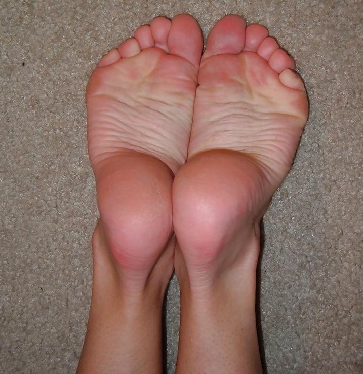 17P Pretty Toes and Wrinkled Soles