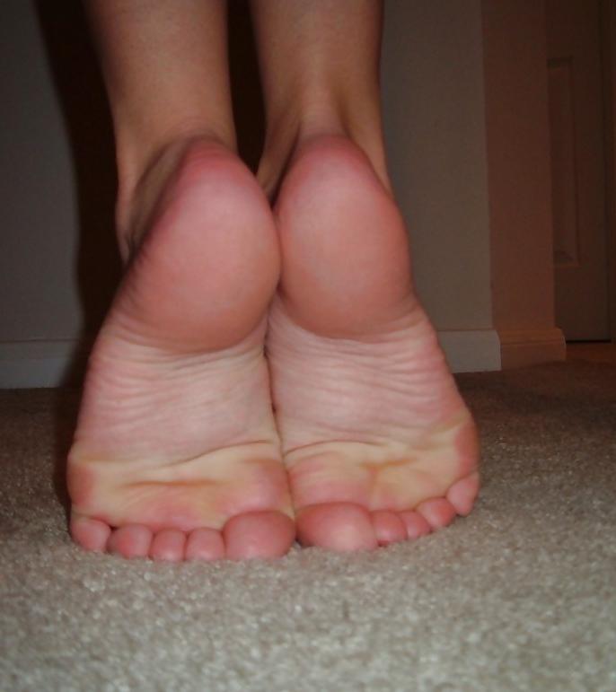 17P Pretty Toes and Wrinkled Soles