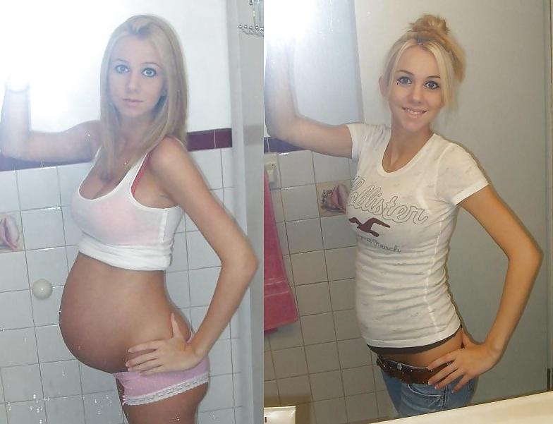 25P Pregnant Misc 