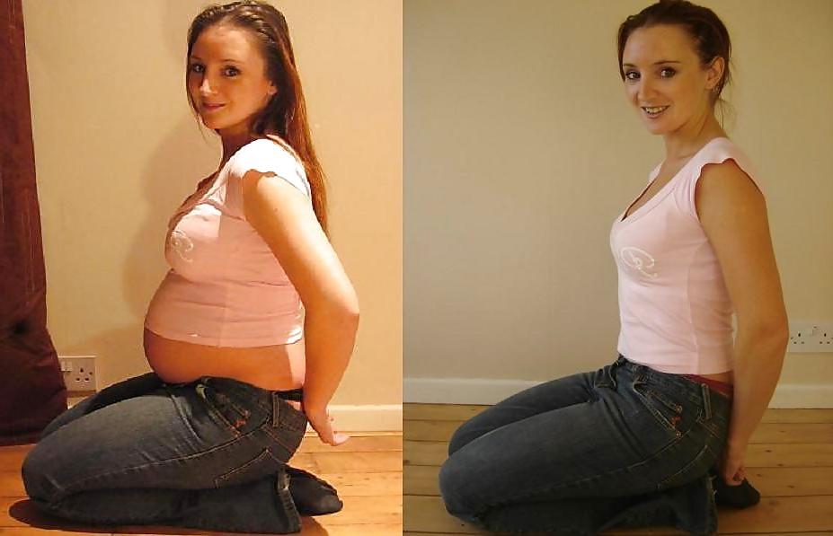 25P Pregnant Misc 