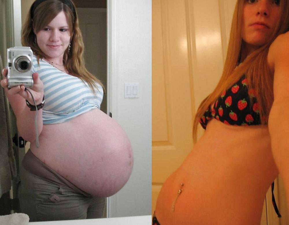 25P Pregnant Misc 