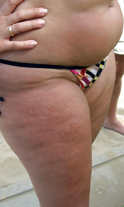 25P Thick, White, and Cellulite 38