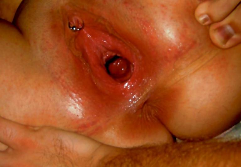 14P Several of my GF's ex's had huge cocks leaving a big pussy