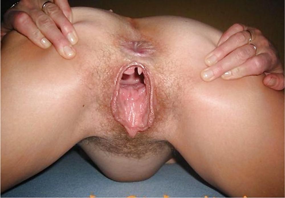 25P Huge cunt