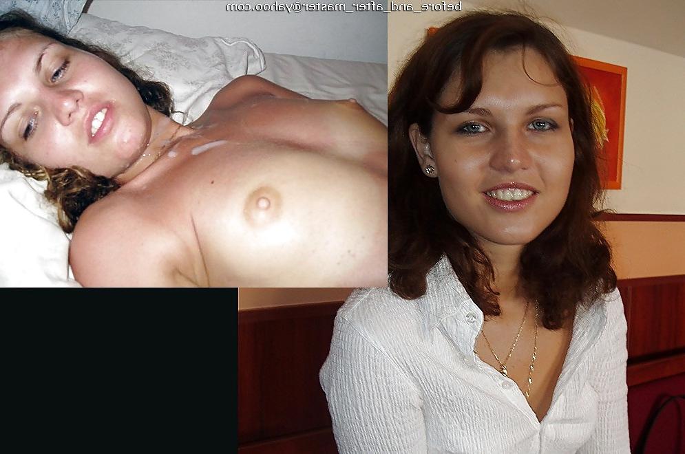 20P Before and after pics - 3