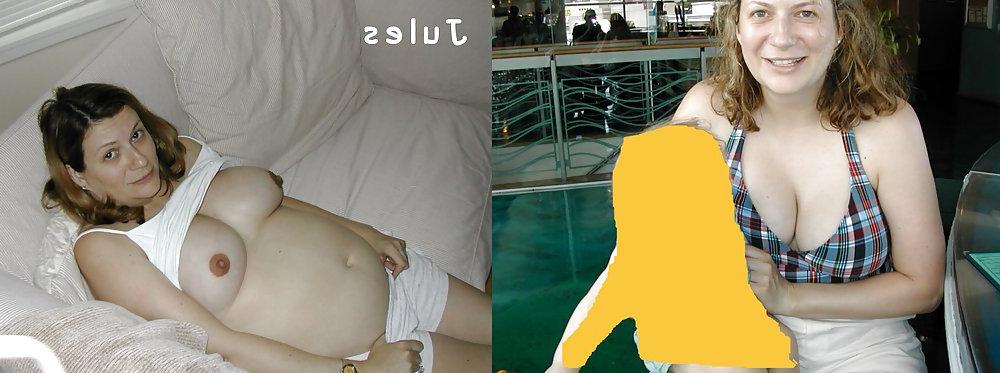 13P Before after 6 pregnant special