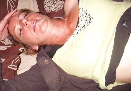 25P Facials