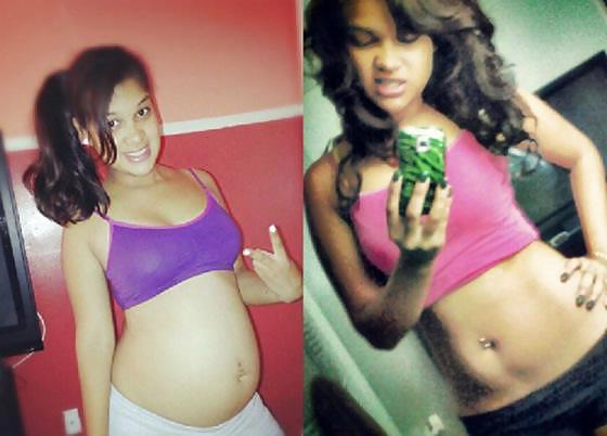 22P Before and After - Pregnant
