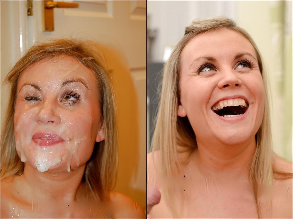 25P Before and After Facials 5