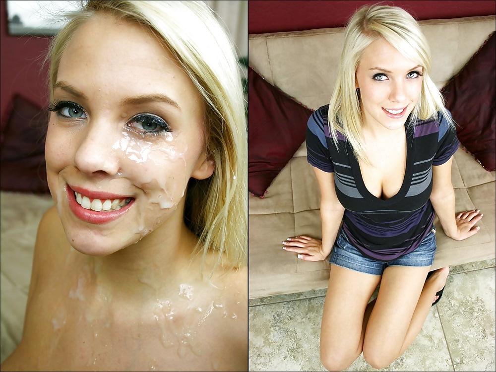25P Before and After Facials 5