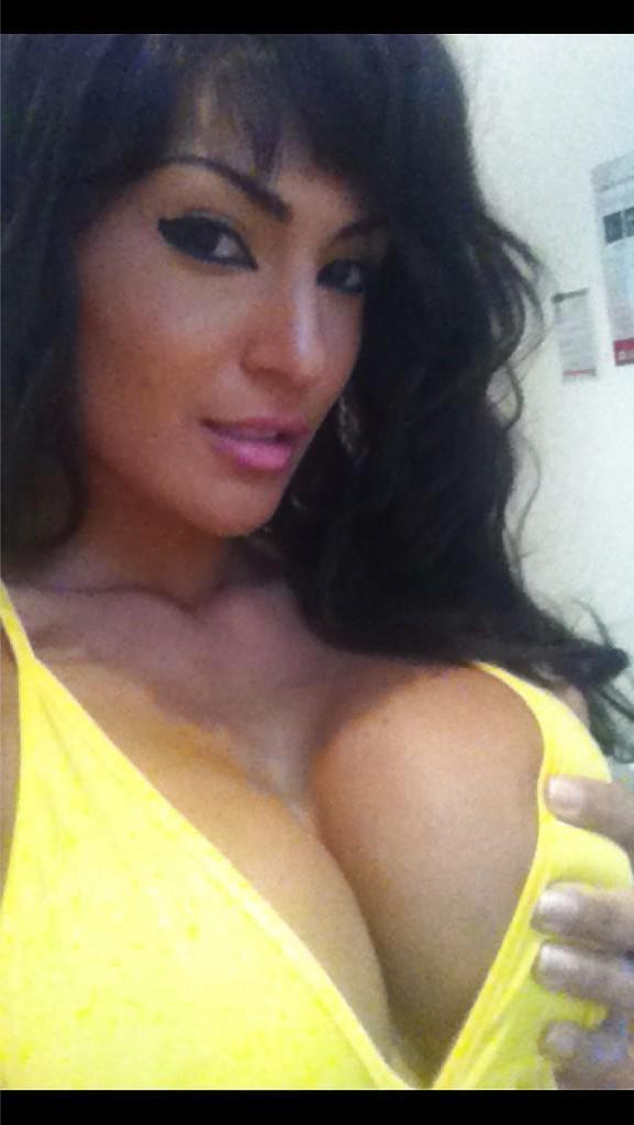 25P Fernanda Shows Off Her Huge Fake Tits