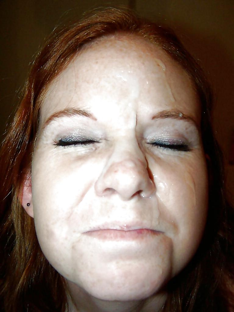 7P Redhead Facials