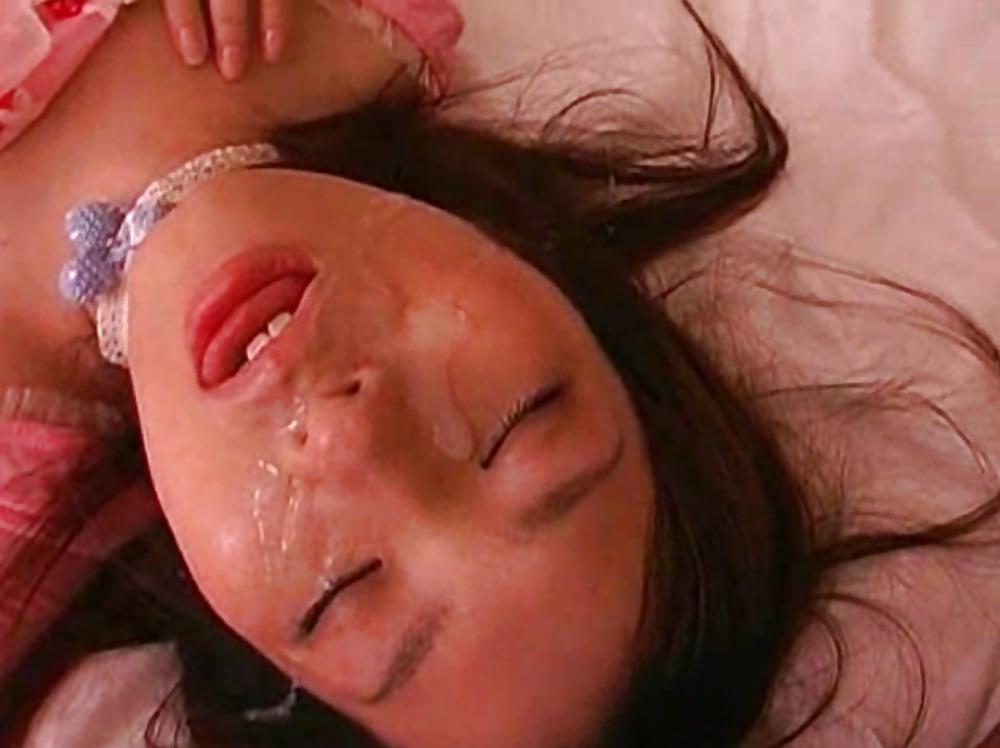 25P Facials... before, during and after shot.