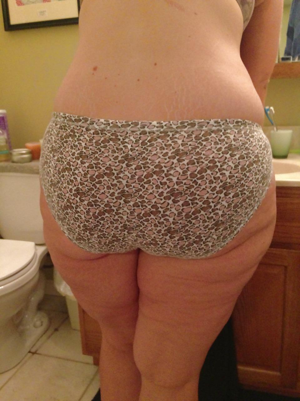 25P Thick, White and Cellulite 116 