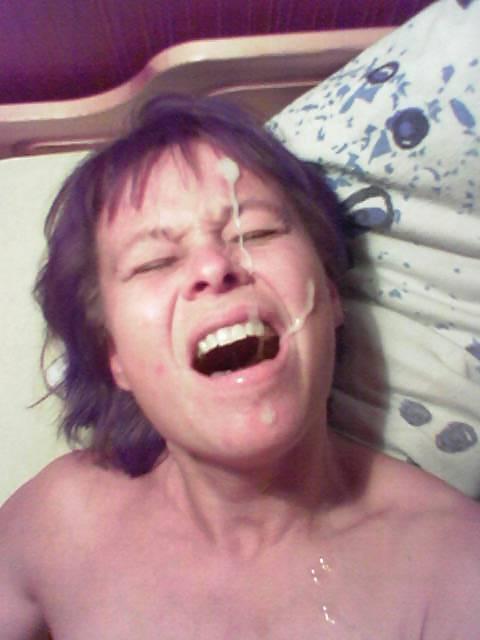 25P (BD) Facials
