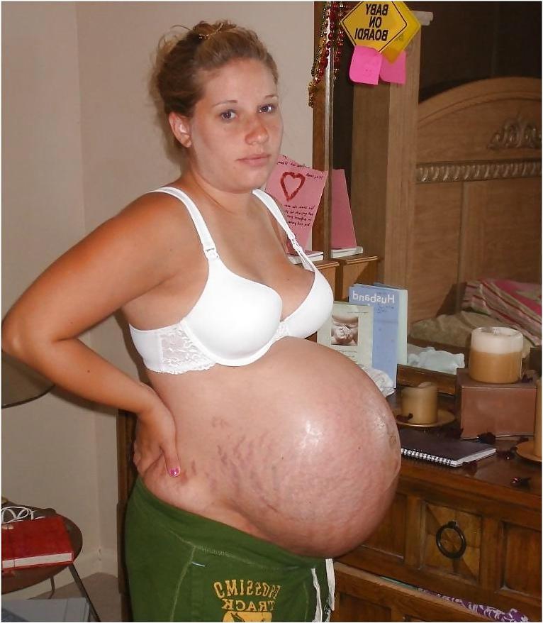25P Pregnant babes!