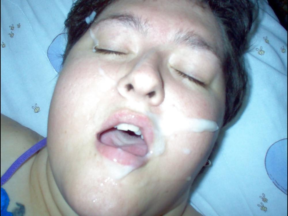 17P HOT FACIALS