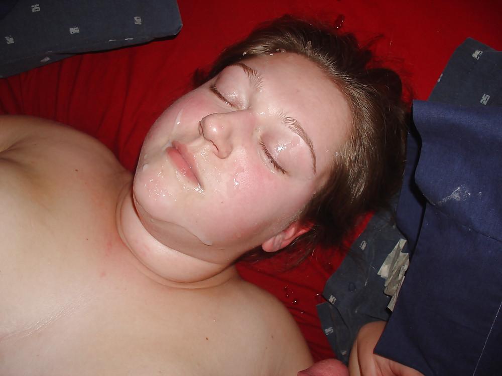 17P HOT FACIALS