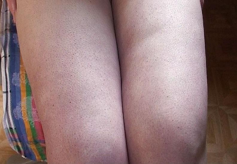17P Granny's thick legs and thighs