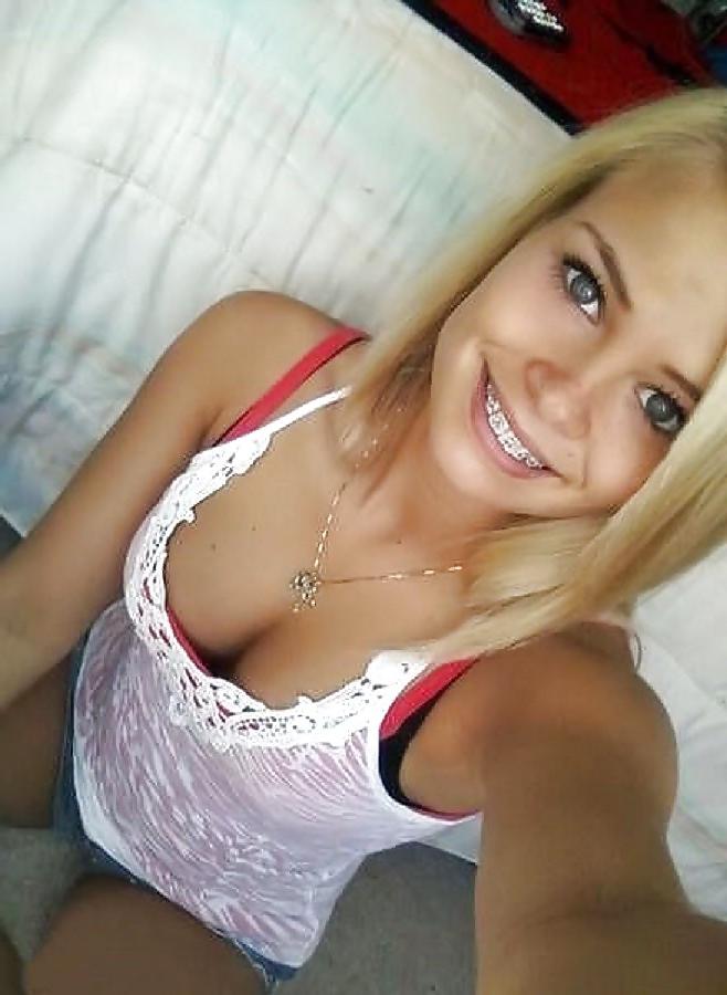 14P Teenie-Klammer-Gesicht! 1