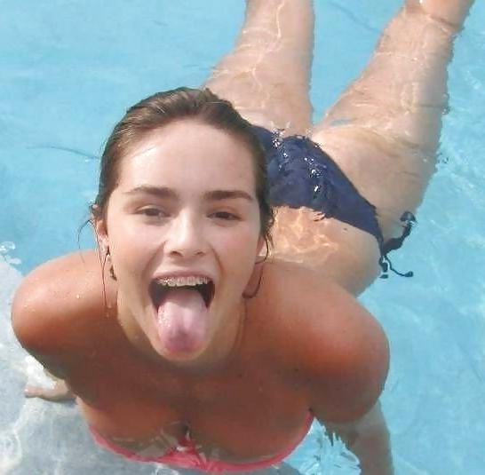 14P Teenie-Klammer-Gesicht! 1