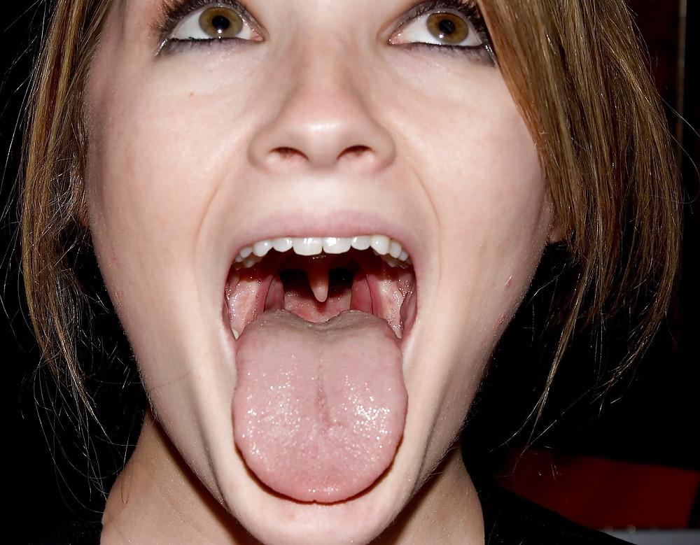 23P Open mouth teen for facial