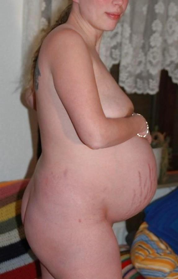 10P Pregnant Stretchmarks
