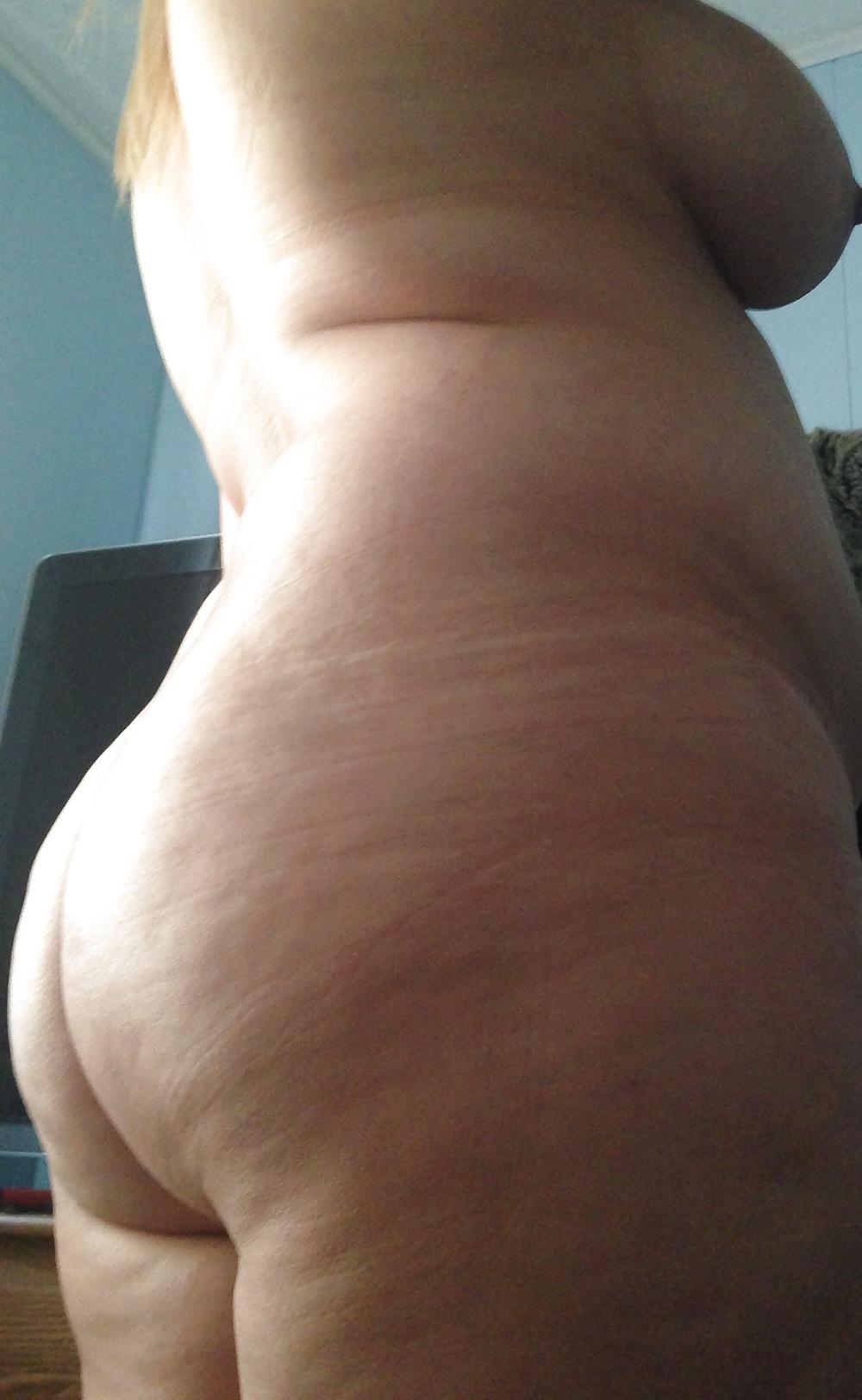 25P Thick, White and Cellulite 117