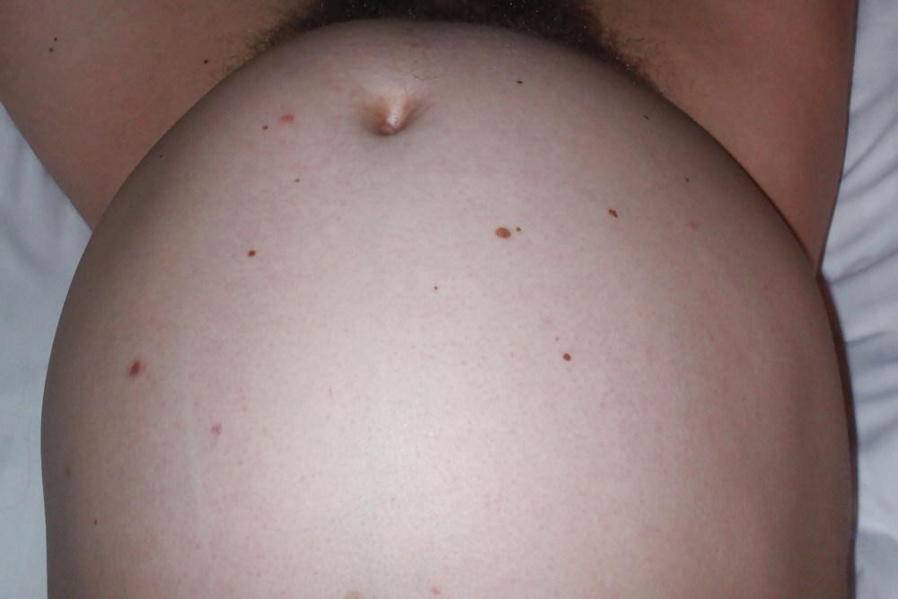 23P Me 8 months pregnant