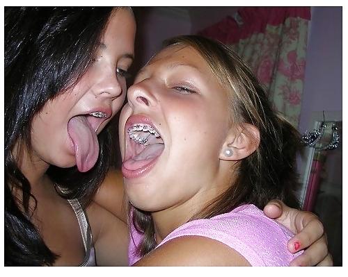 19P Sexy girls with braces