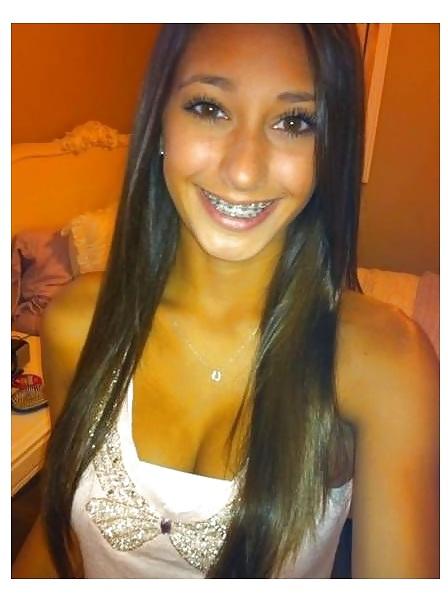 19P Sexy girls with braces