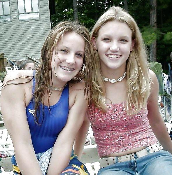 19P Sexy girls with braces