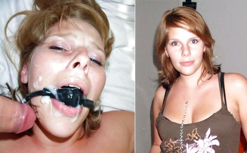 22P Before and After Facials