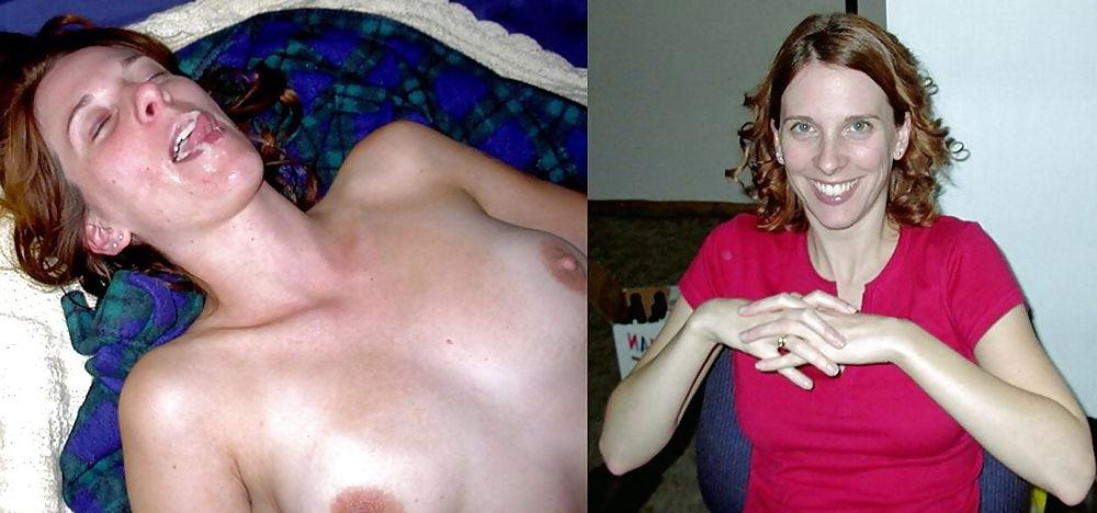 22P Before and After Facials