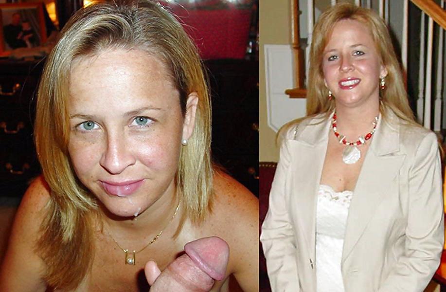 22P Before and After Facials