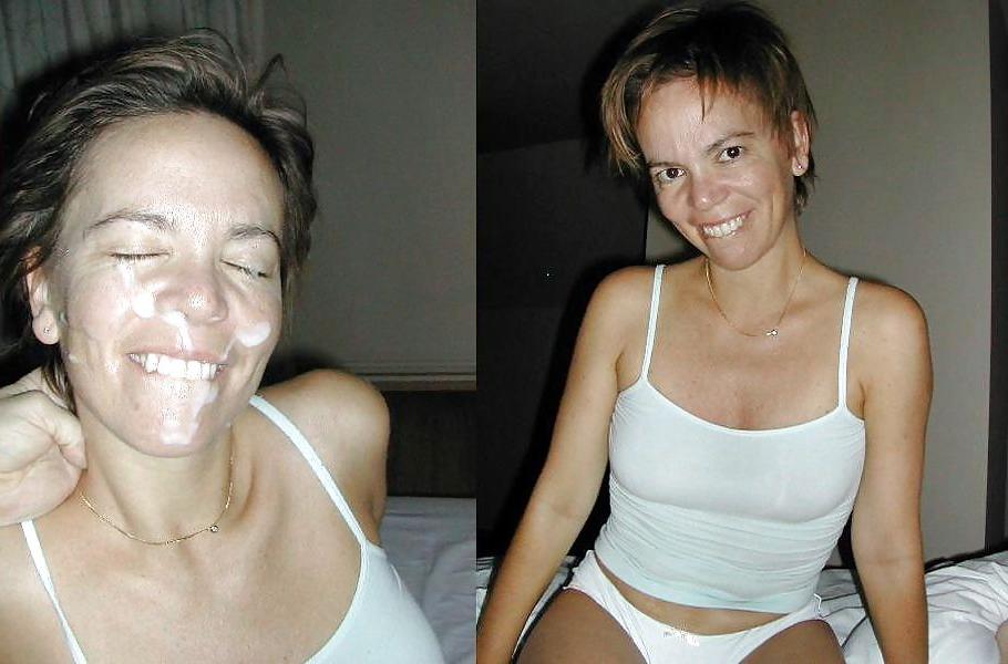 22P Before and After Facials