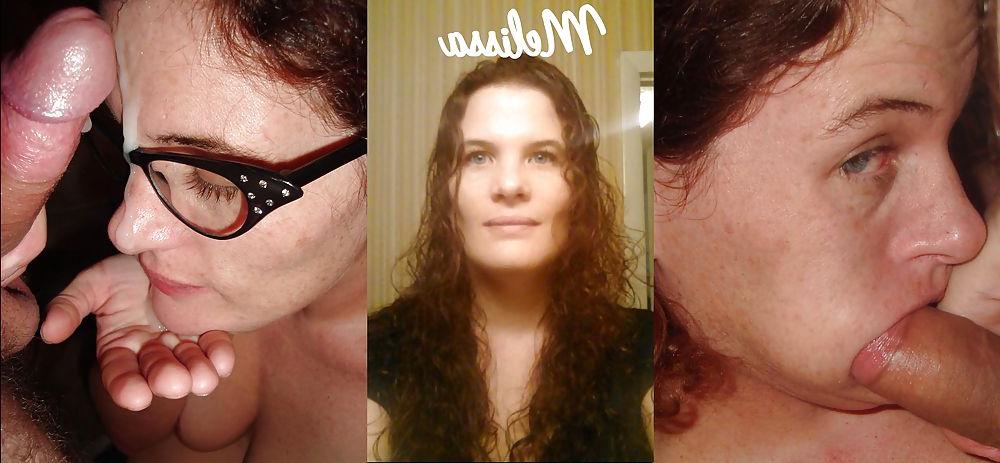 22P Before and After Facials