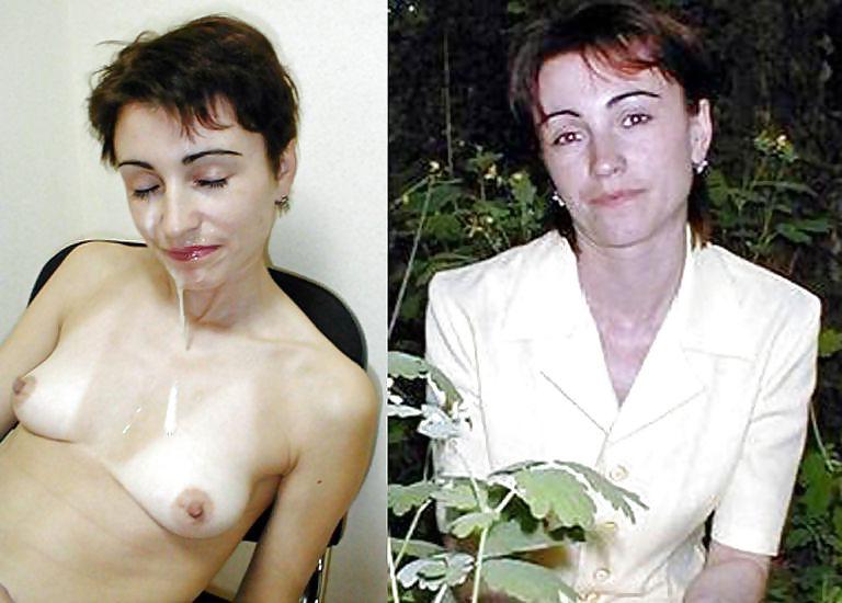 22P Before and After Facials