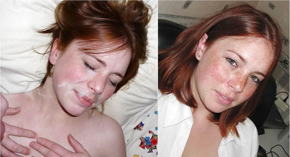 22P Before and After Facials