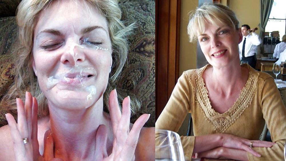 22P Before and After Facials
