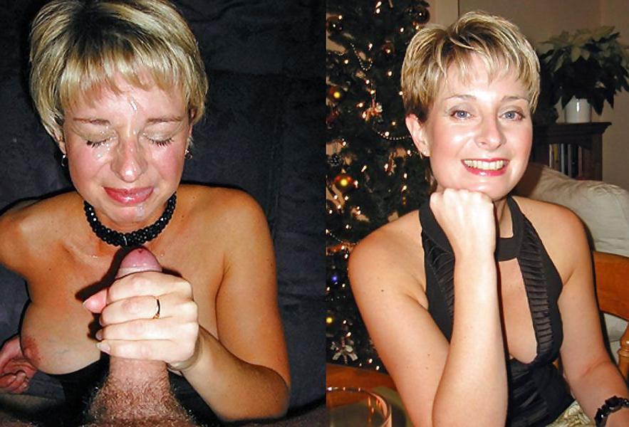 22P Before and After Facials