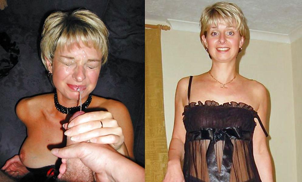 22P Before and After Facials