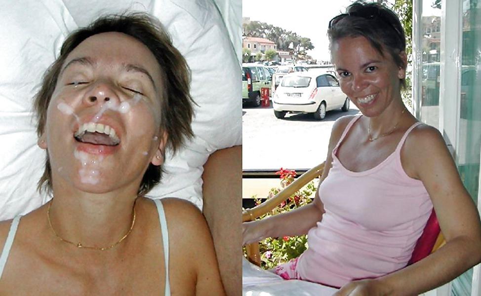 22P Before and After Facials