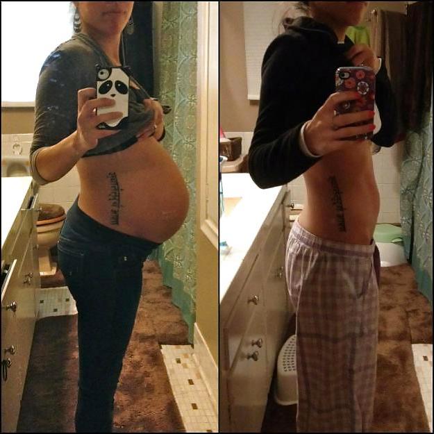 25P Before and After Pregnant Bellies