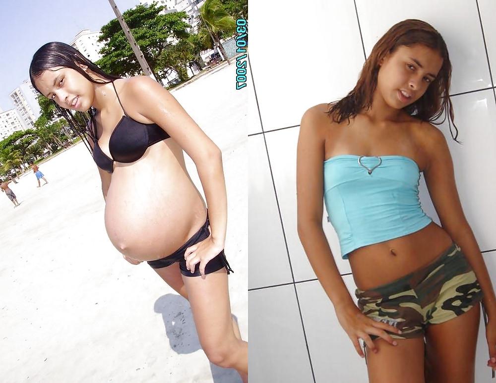 25P Before and After Pregnant Bellies